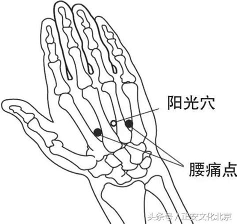 陽光穴|萬一針醫案系列連載（一）：針刺陽光穴